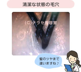 清潔な状態の毛穴 髪のツヤまで違いますね♪