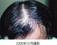 男性例1