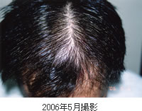 男性例2