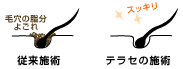 従来の施術とテラセの施術の違い