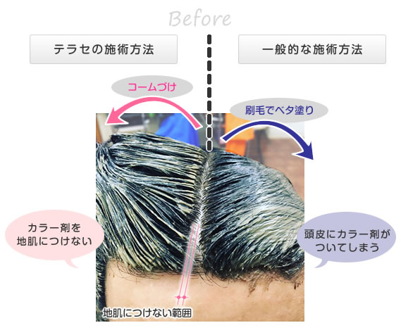 一般的な施術方法との違い