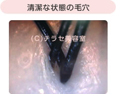 清潔な状態の毛穴