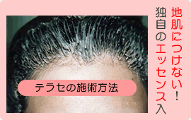 テラセの施術方法