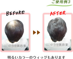 部分用カツラご使用例3 明るいカラーのウィッグもあります